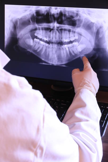 Best Emergency Denture Repair in Big Bear City, CA
