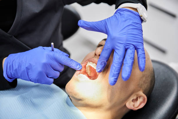 Best Emergency Treatment for Dental Infections or Abscesses in Big Bear City, CA